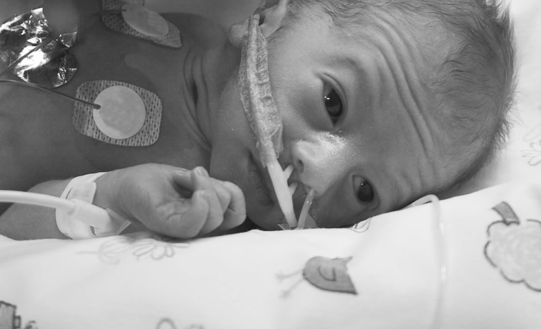 intrauterine growth restriction intrauterine growth restriction